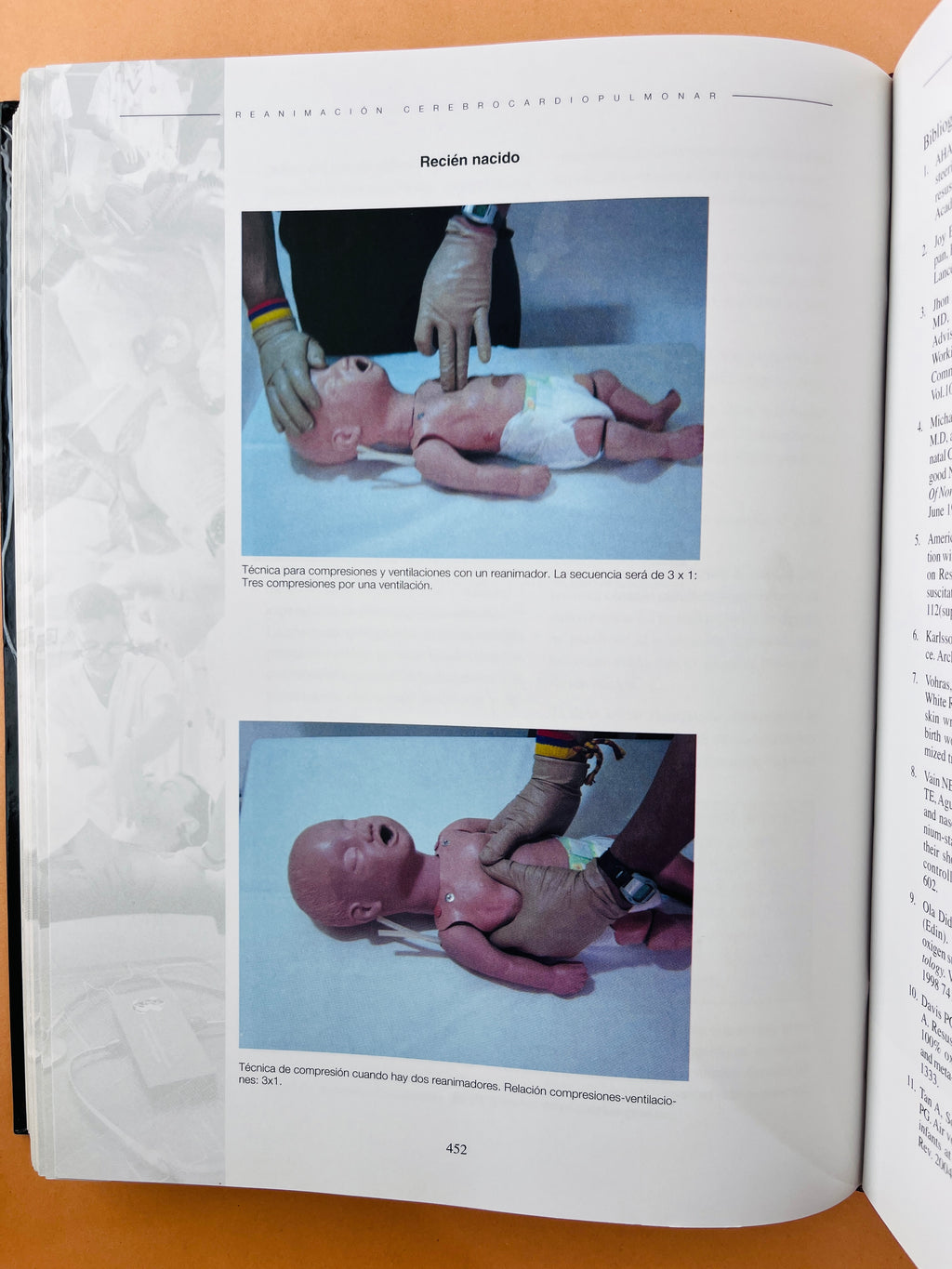 Reanimación Cerebrocardiopumonar asuntos críticos segunda edición by Laureano Quintwero B.