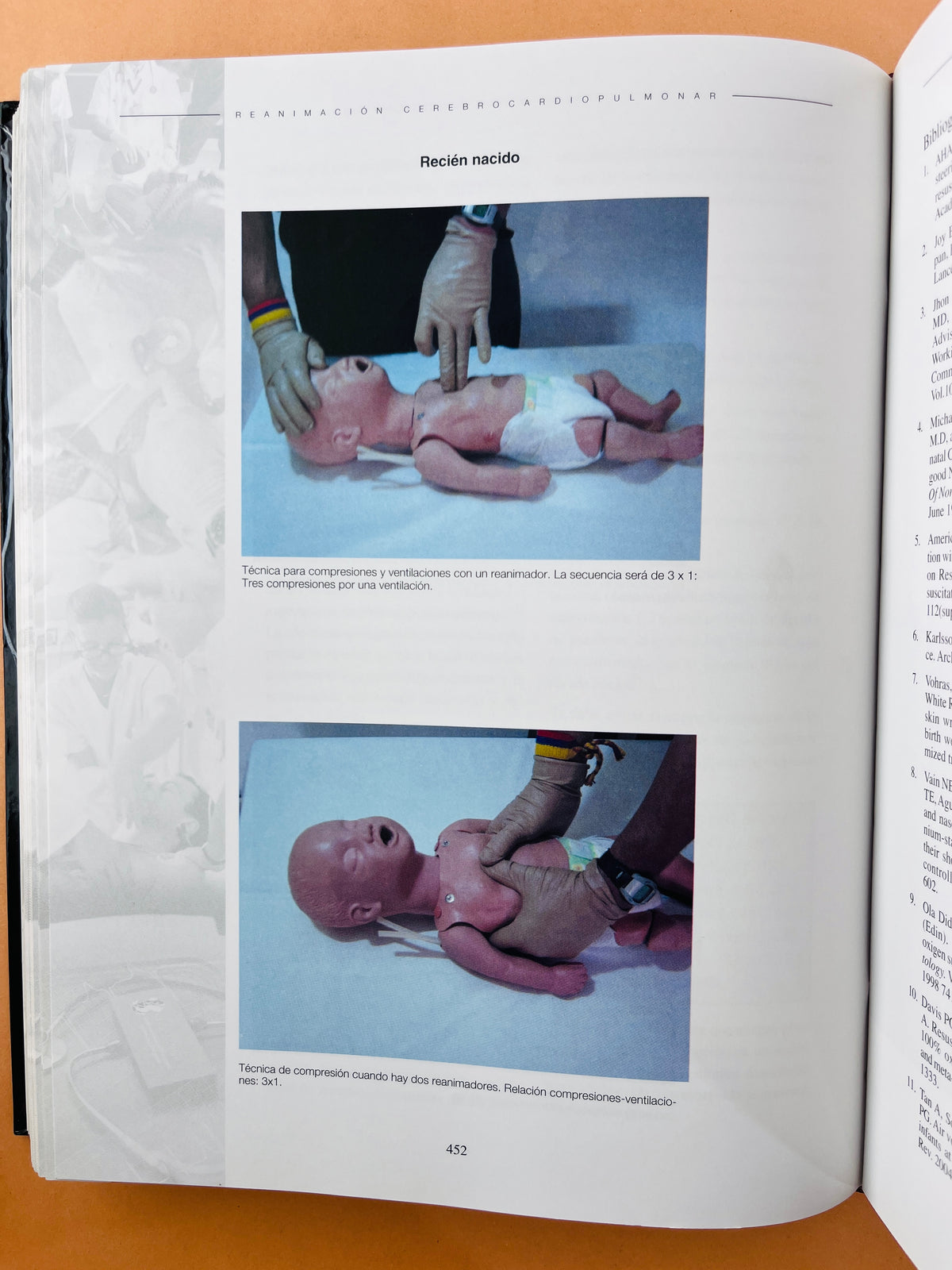 Reanimación Cerebrocardiopumonar asuntos críticos segunda edición by Laureano Quintwero B.