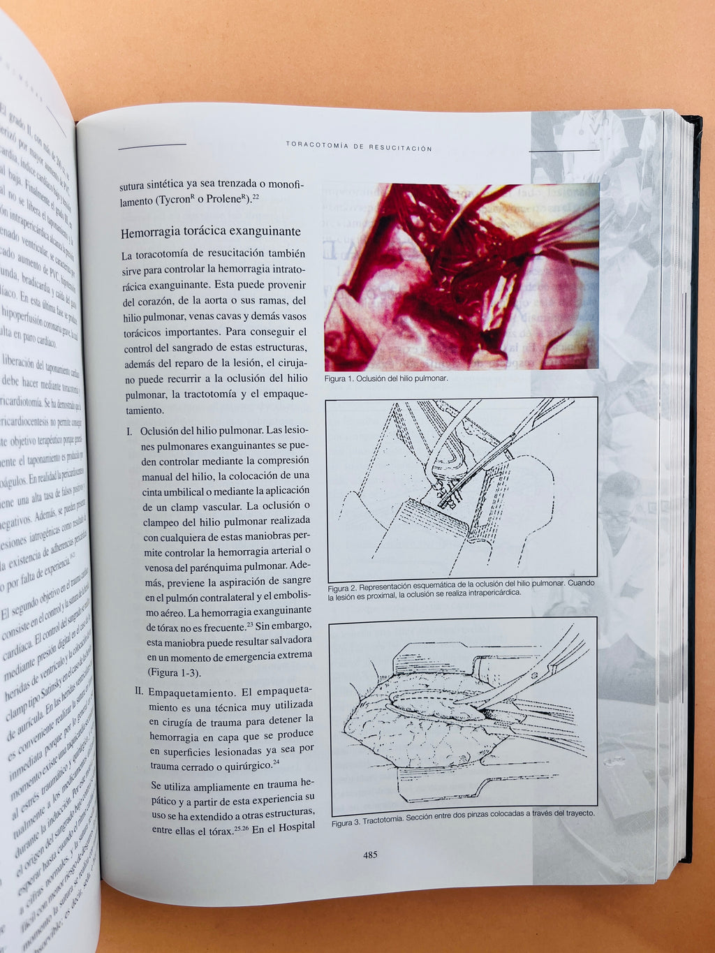 Reanimación Cerebrocardiopumonar asuntos críticos segunda edición by Laureano Quintwero B.