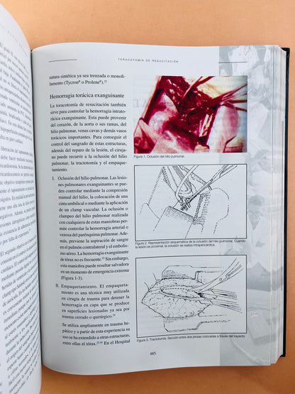 Reanimación Cerebrocardiopumonar asuntos críticos segunda edición