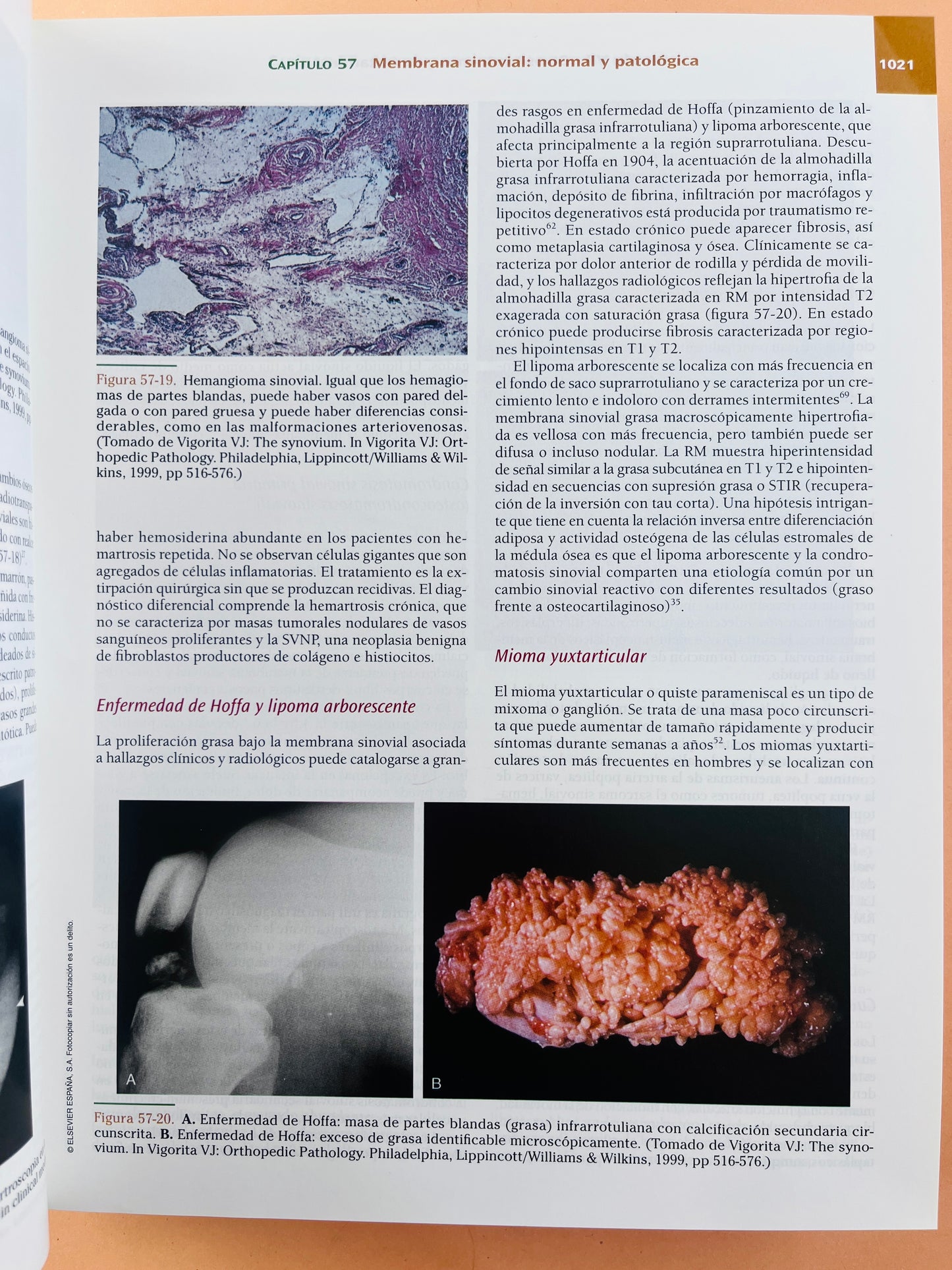 Insall y Scott Cirugía de la Rodilla cuarta edición volumen 2