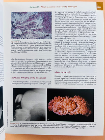 Insall y Scott Cirugía de la Rodilla cuarta edición volumen 2