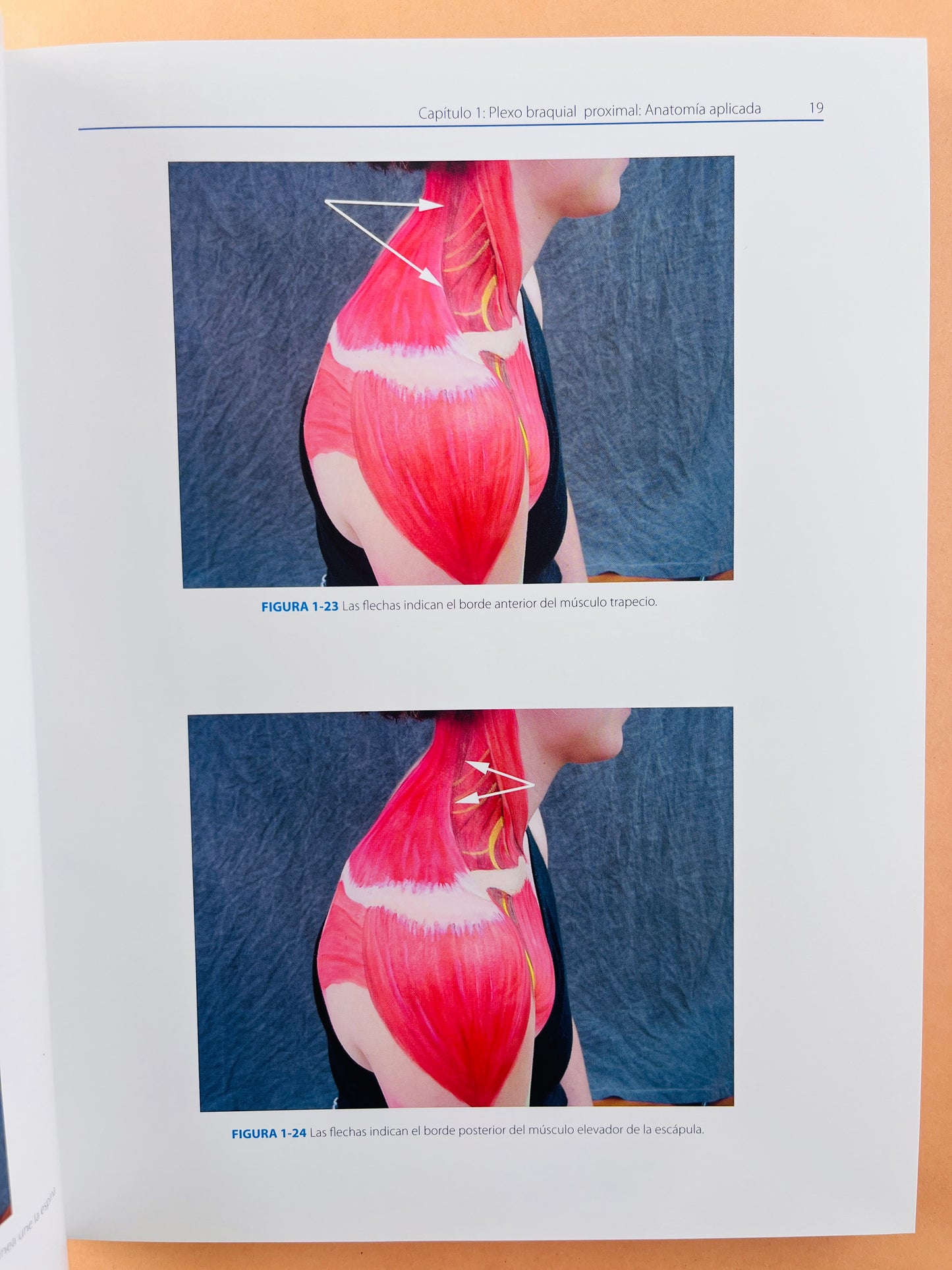 Atlas de Bloqueos Nerviosos Periféricos y Anatomía para Anestesia Ortopédica