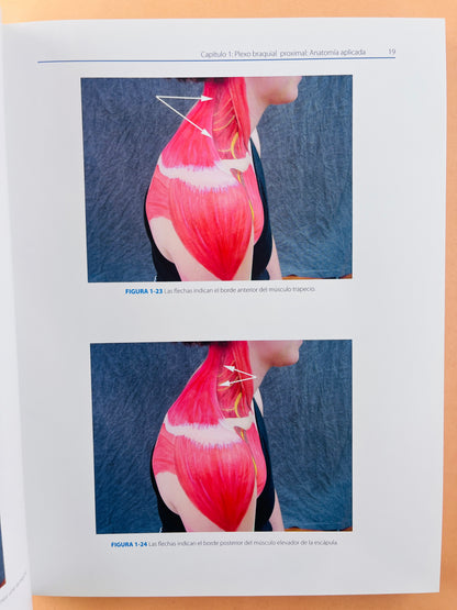 Atlas de Bloqueos Nerviosos Periféricos y Anatomía para Anestesia Ortopédica