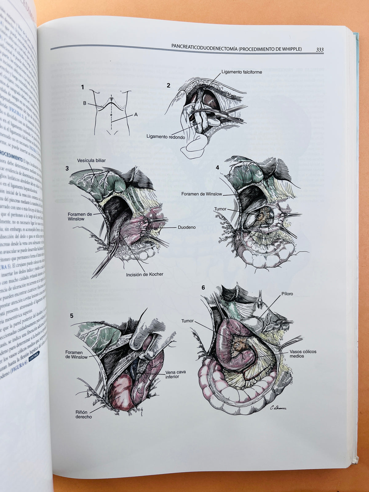 Zollinger´s Atlas de Operaciones Quirúrgicas décima edición by E. Christopher Ellison Robert M. Zollinger,JR