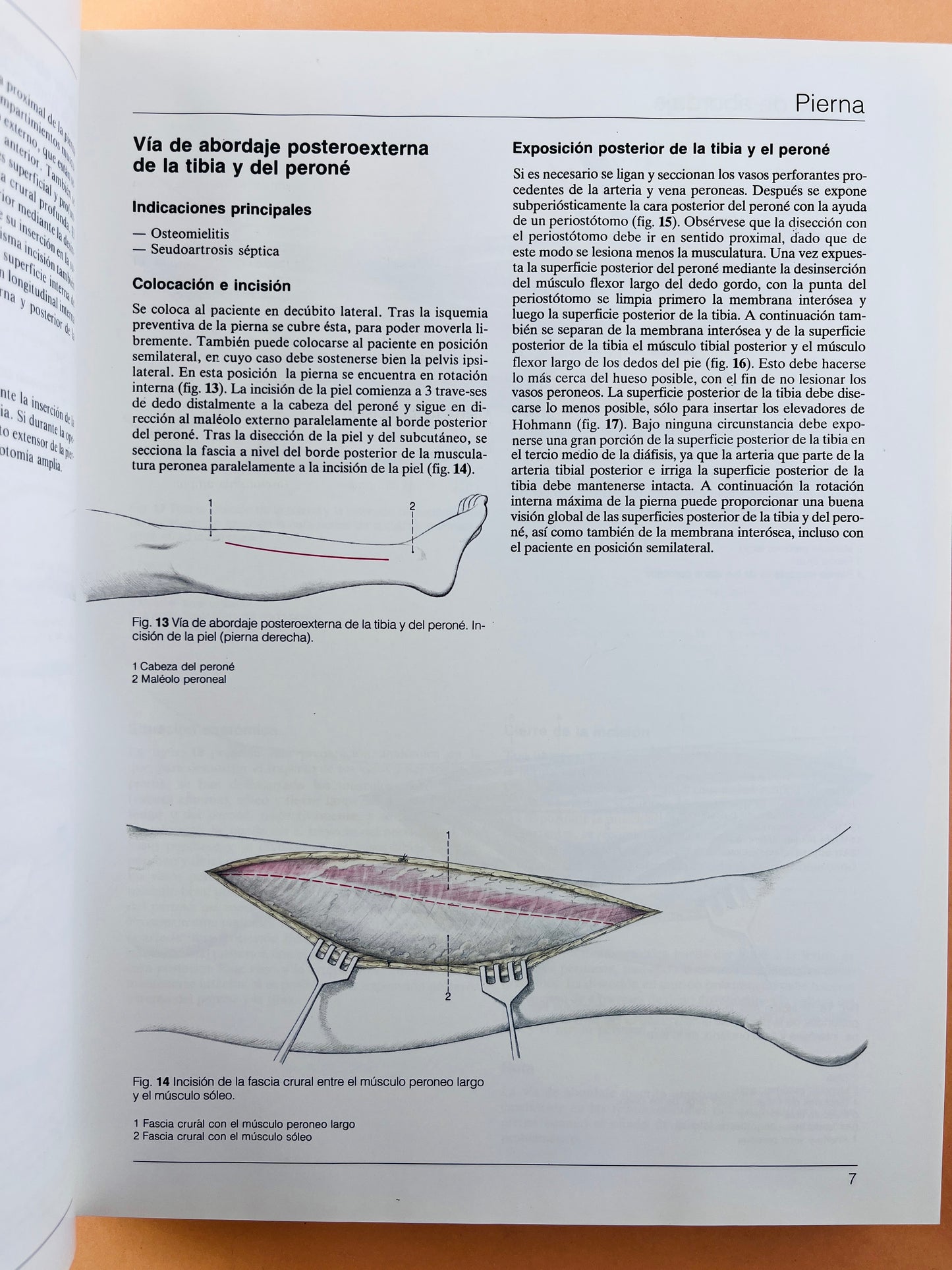 Cirugía Ortopédica Pie y Tobillo con técnicas microquirúrgicas generales