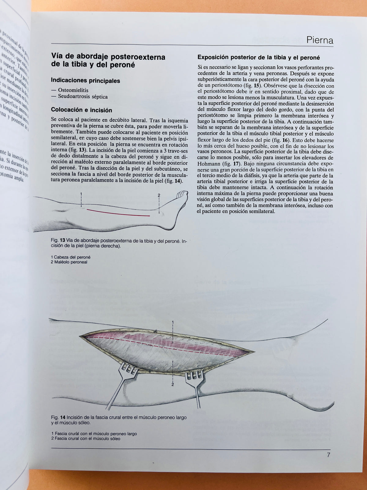 Cirugía Ortopédica Pie y Tobillo con técnicas microquirúrgicas generales by Bauer Kerschbaumer Poisel