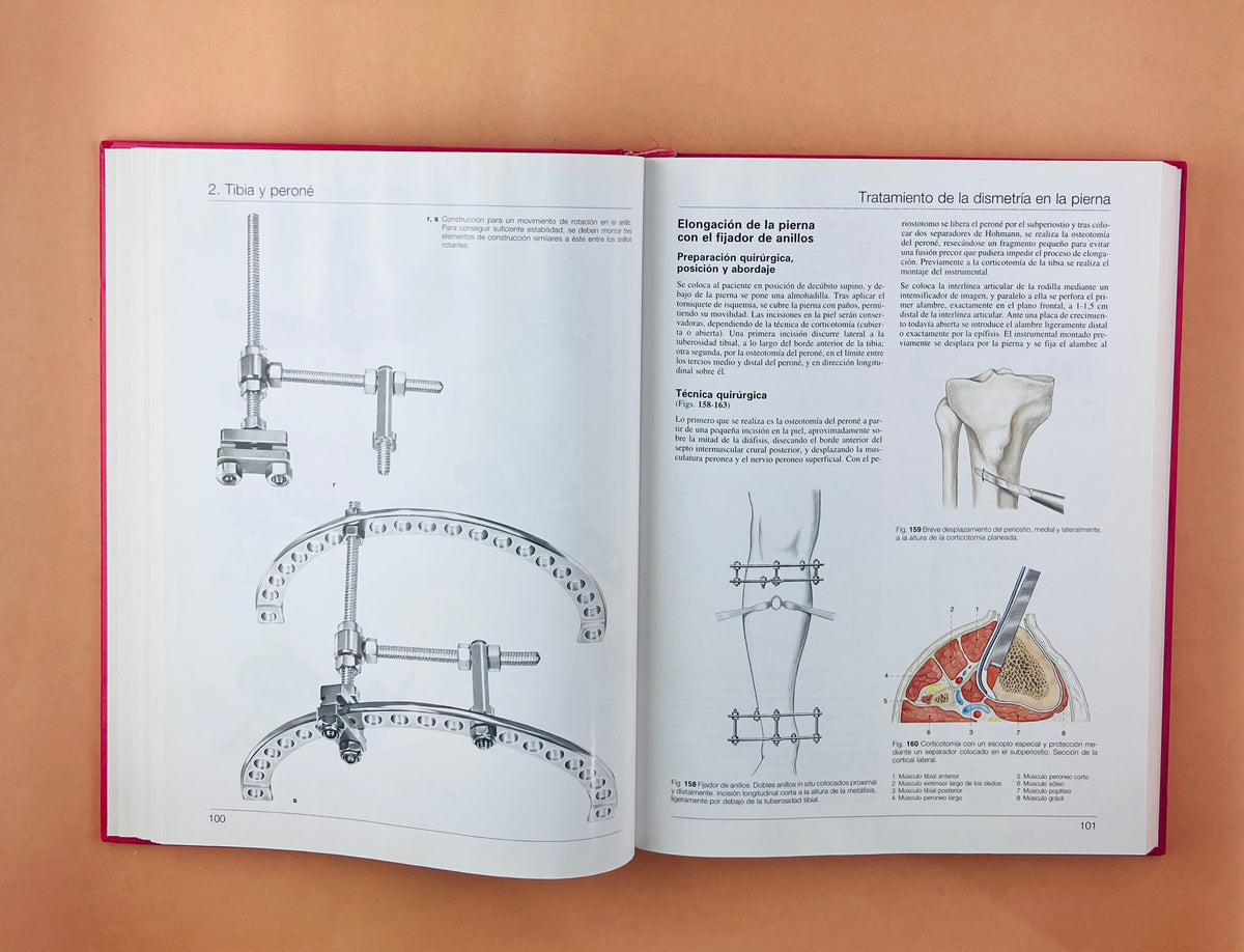 Cirugía Ortopédica Pie y Tobillo con técnicas microquirúrgicas generales by Bauer Kerschbaumer Poisel