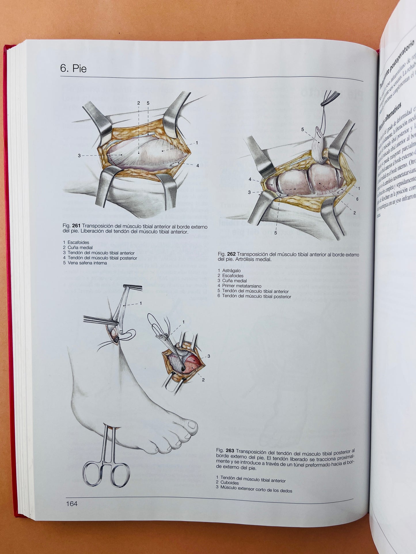 Cirugía Ortopédica Pie y Tobillo con técnicas microquirúrgicas generales