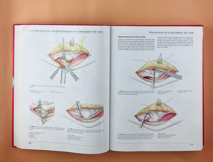 Cirugía Ortopédica Mano Muñeca Antebrazo Codo Hombro