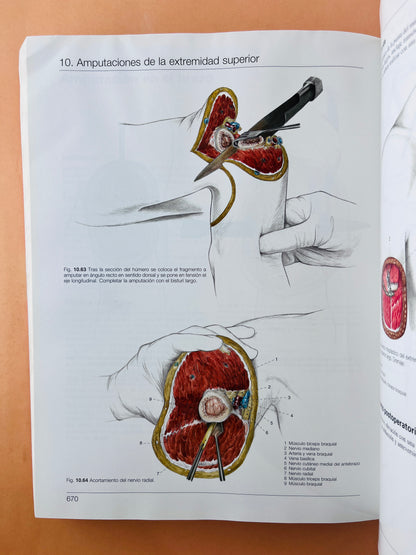 Cirugía Ortopédica Mano Muñeca Antebrazo Codo Hombro