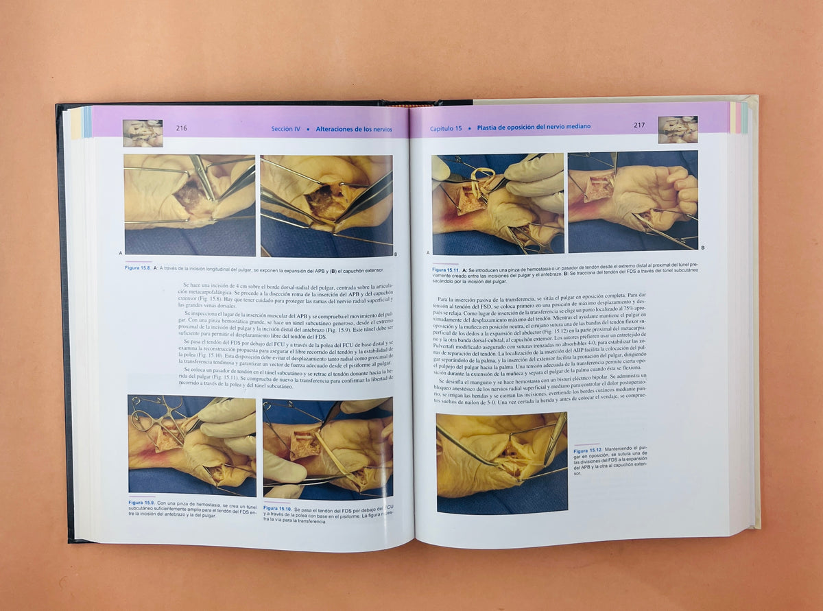 Strickland & Graham Técnicas en Cirugía Ortopédica Mano by James W. Strickland Thomas J. Graham