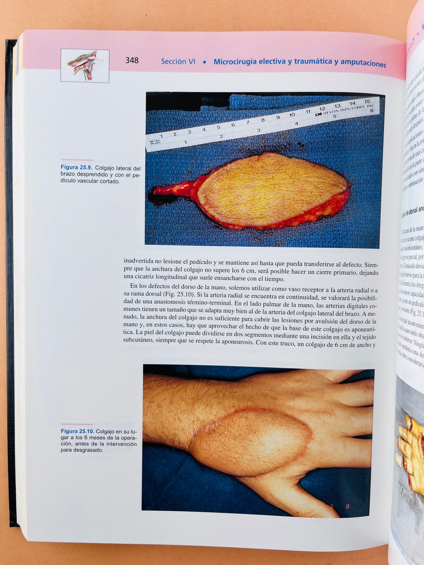 Strickland & Graham Técnicas en Cirugía Ortopédica Mano