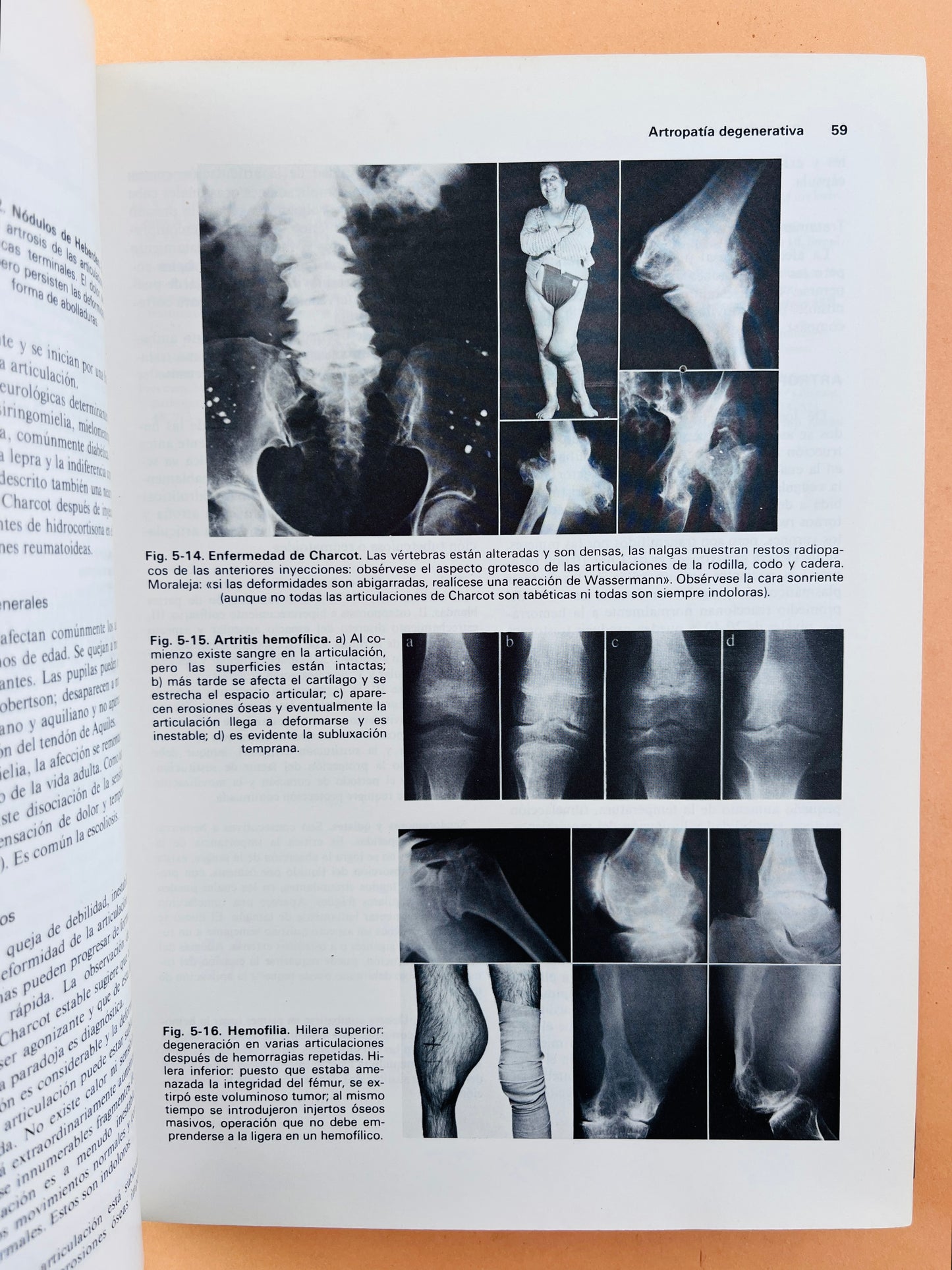 Ortopedia y tratamiento de fracturas segunda edición