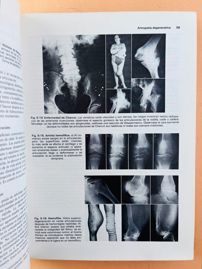 Ortopedia y tratamiento de fracturas segunda edición