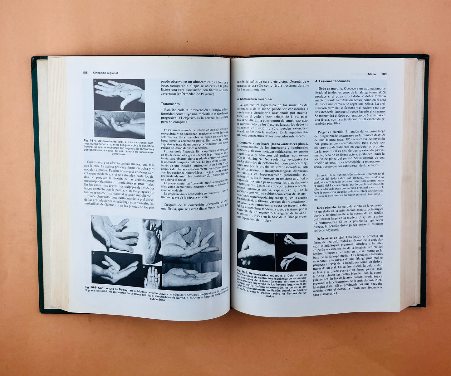 Ortopedia y tratamiento de fracturas segunda edición