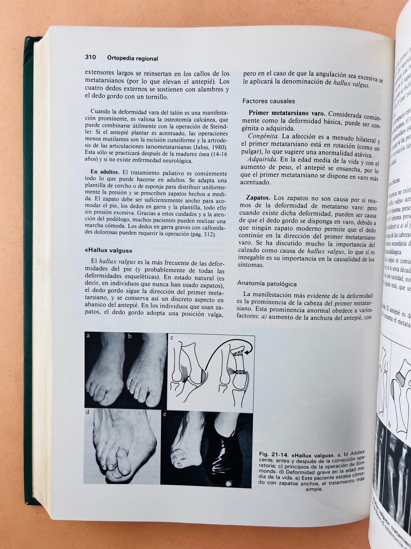 Ortopedia y tratamiento de fracturas segunda edición