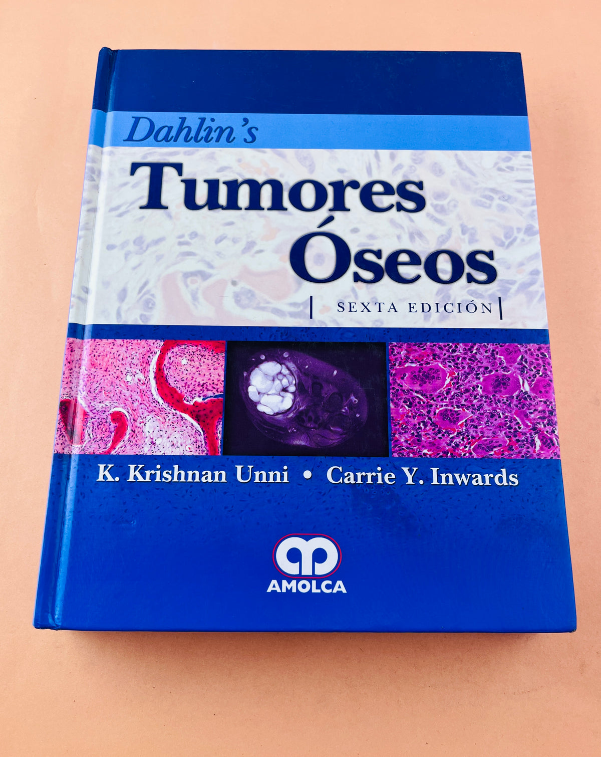 Dahlins Tumores Óseos aspectos y datos generales sobre 10165 casos sexta edición by K.Krishnan Unni Carrie Y. Inwards