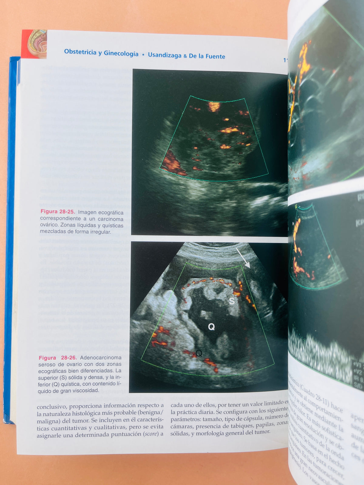Obstetricia y ginecología by Usandizaga De La Fuente