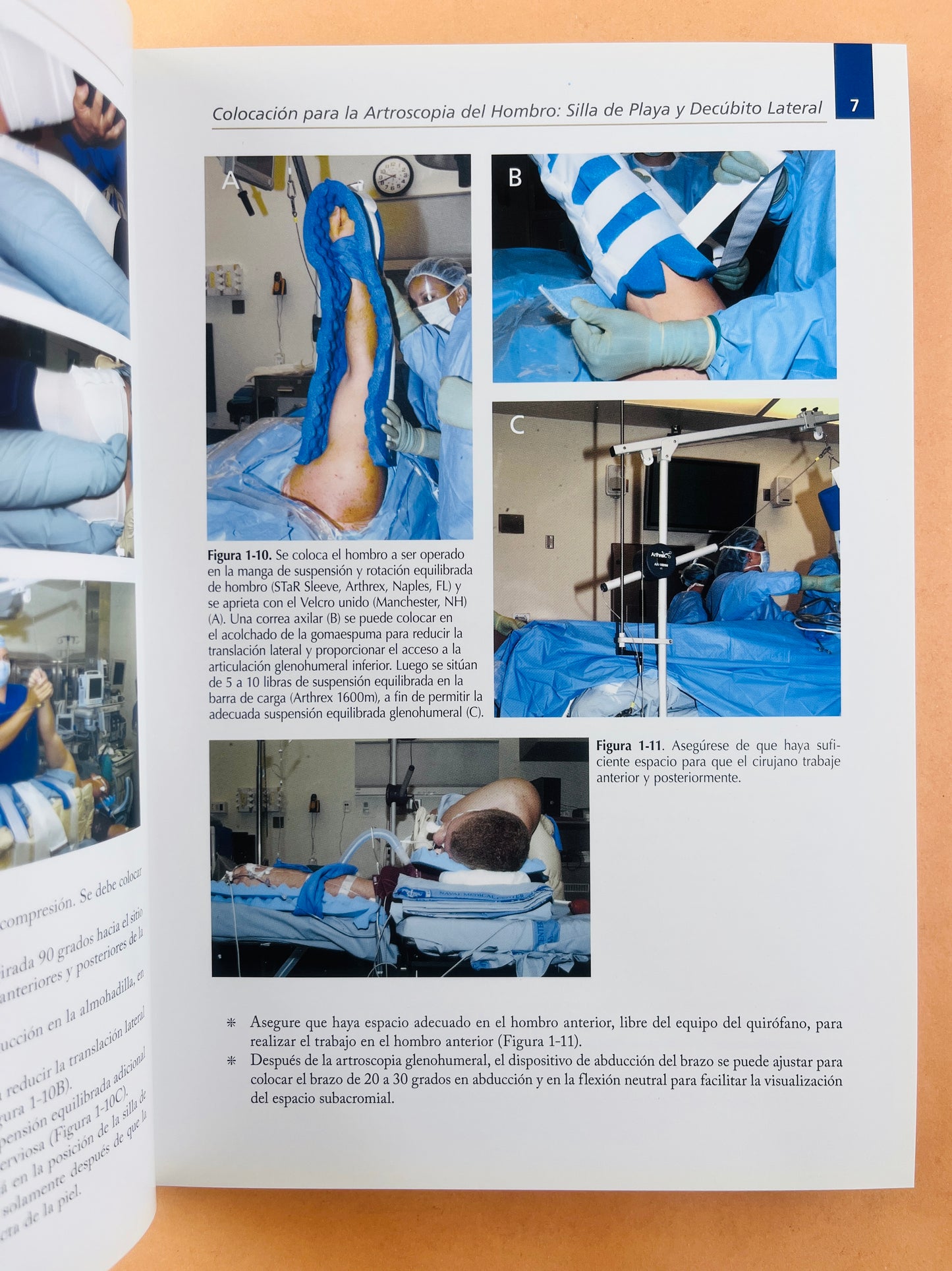 Tips y Perlas Artroscópicas de hombro paso a paso