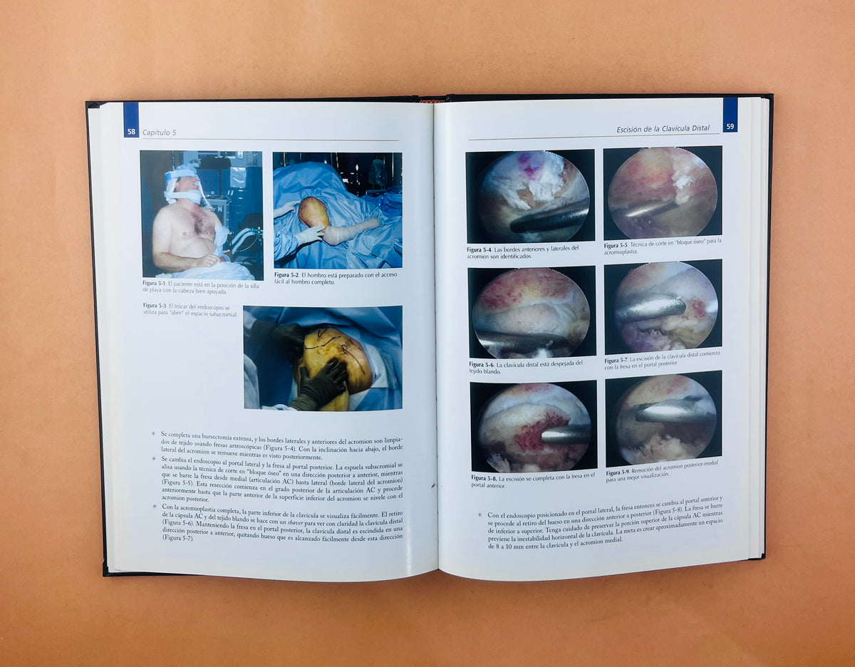 Tips y Perlas Artroscópicas de hombro paso a paso by Tal S. David James R. Andrews