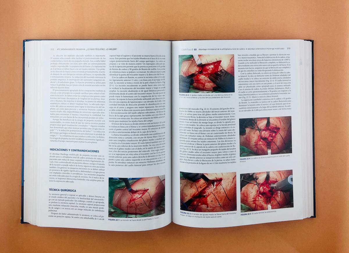 Artritis y Artroplastia Cadera by Thomas E. Brown Quanjun Cui William M. Mihalko Khaled J. Saleh