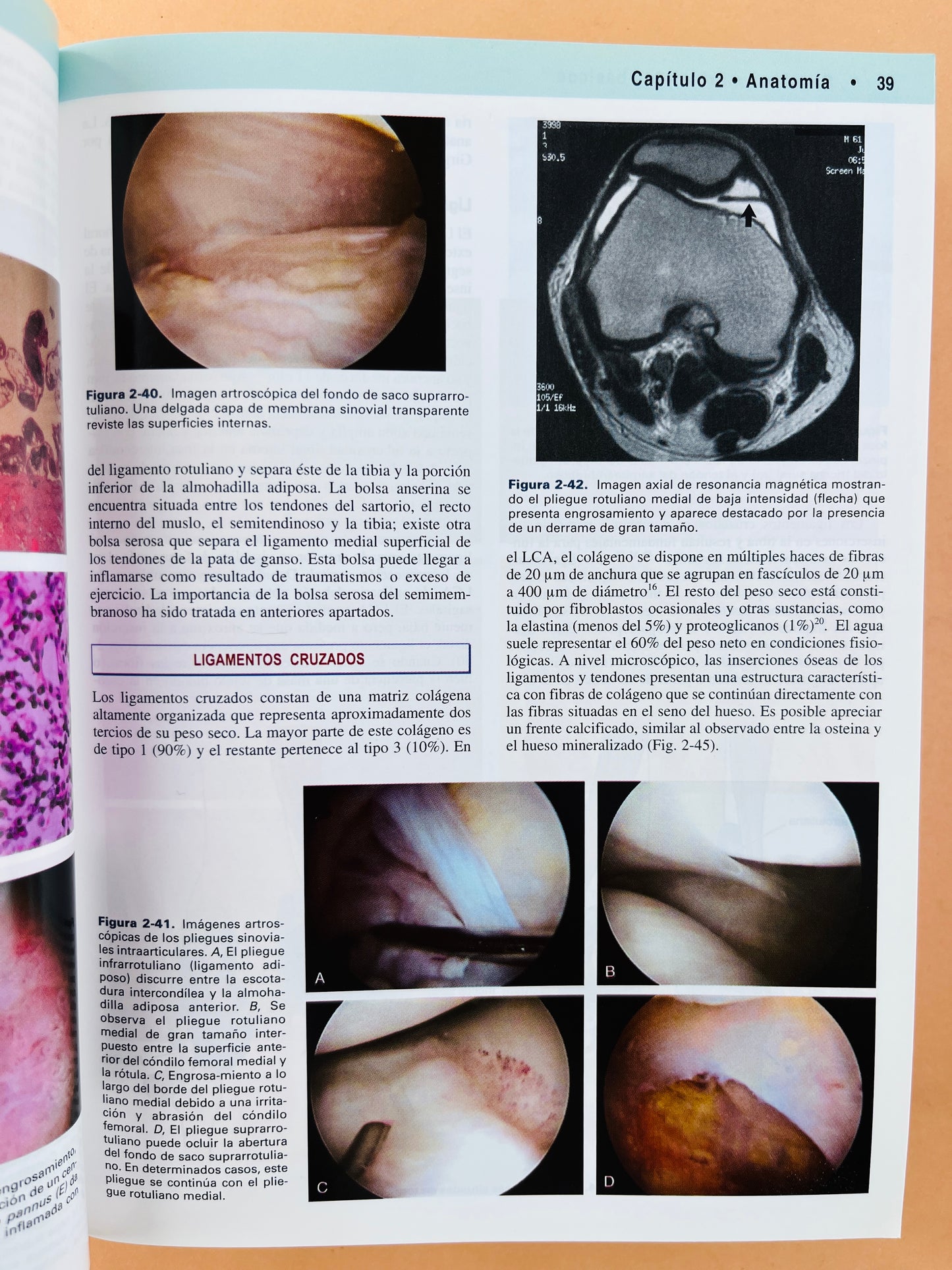 Rodilla 2 volúmenes