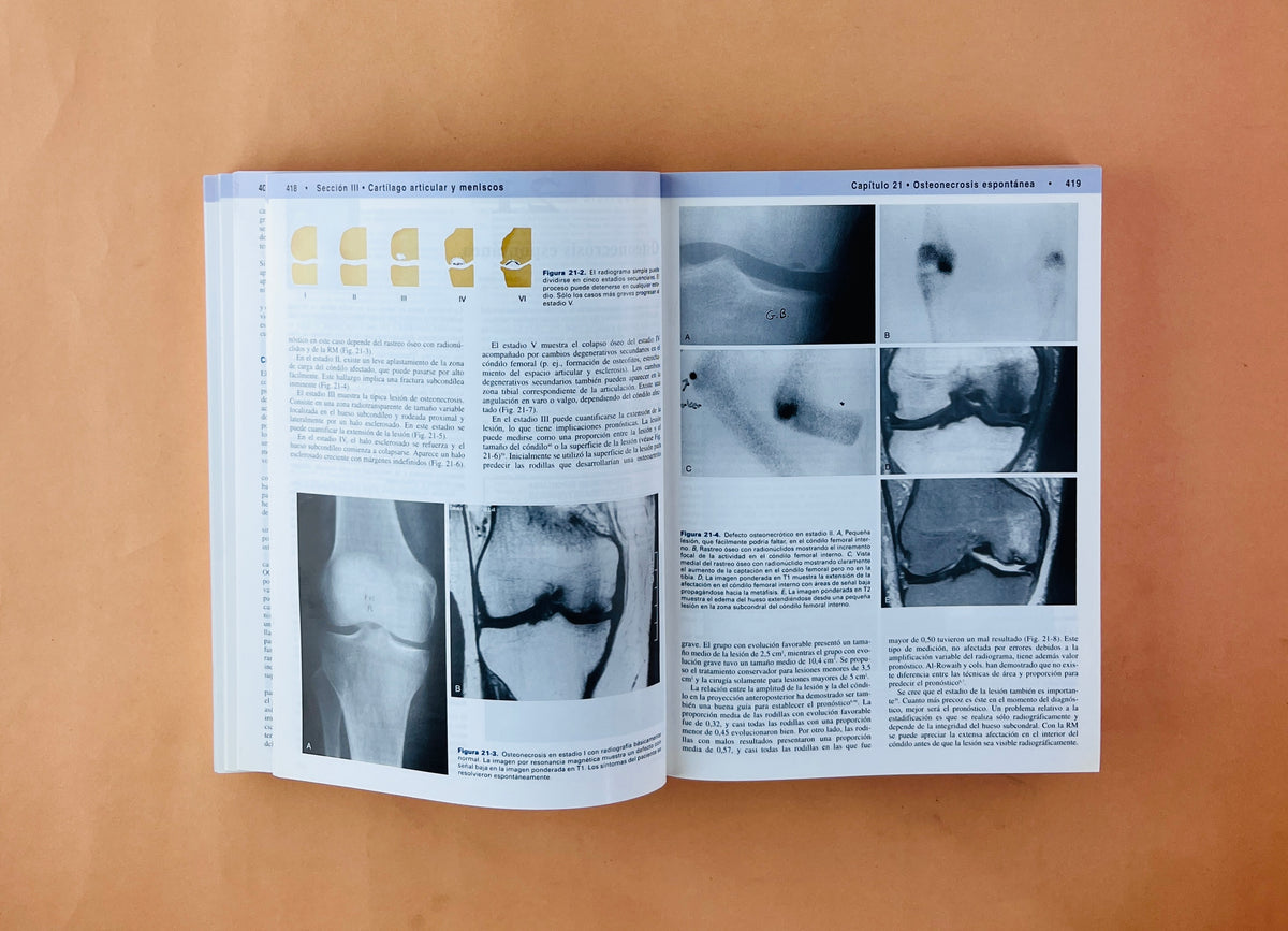 Rodilla 2 volúmenes by Insall & Scott