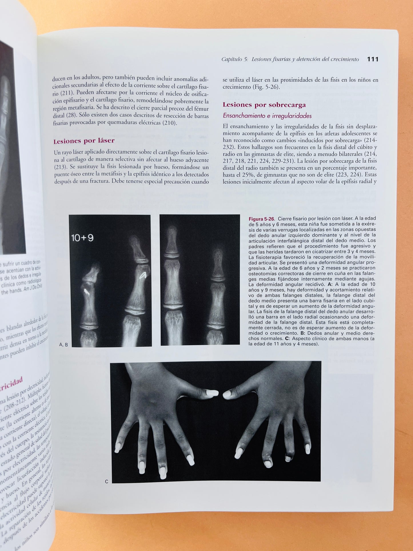 Rockwood & Wilkins Fracturas en el niño quinta edición