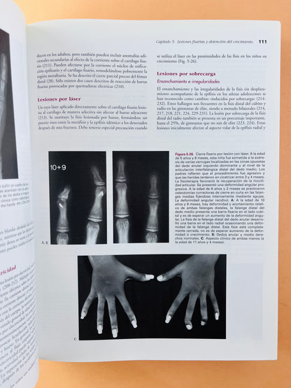Rockwood & Wilkins Fracturas en el niño quinta edición