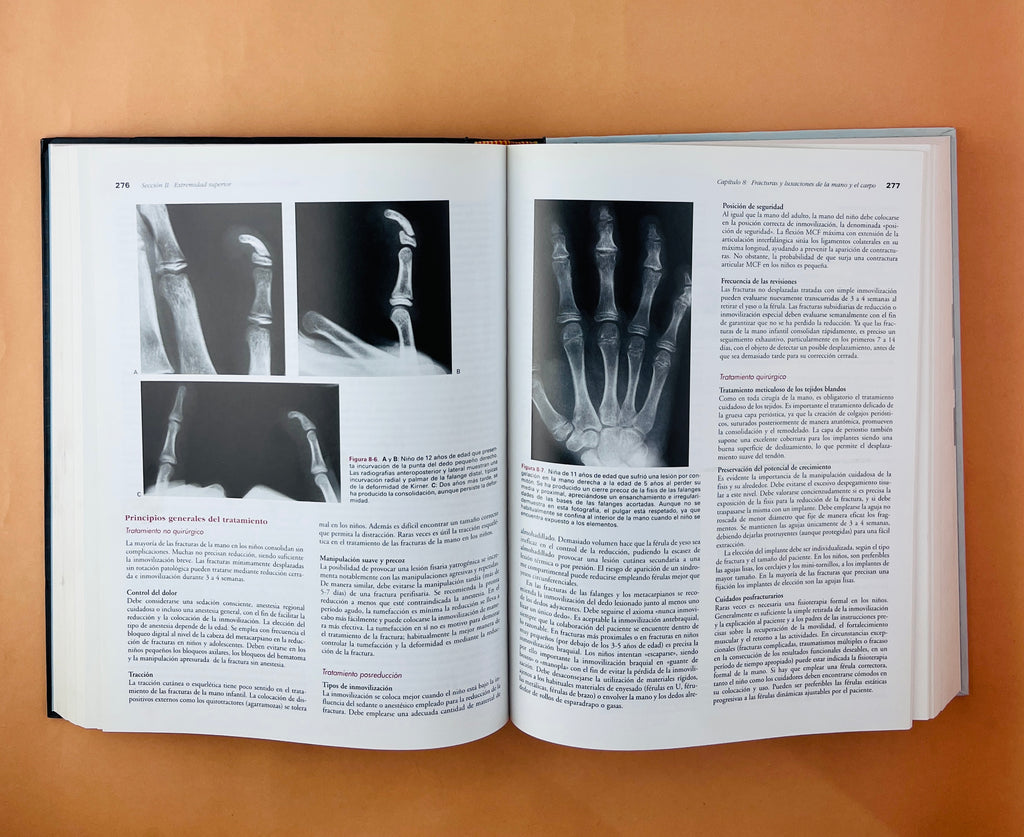 Rockwood & Wilkins Fracturas en el niño quinta edición by James H. Beaty James R. Kasser