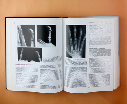 Rockwood & Wilkins Fracturas en el niño quinta edición