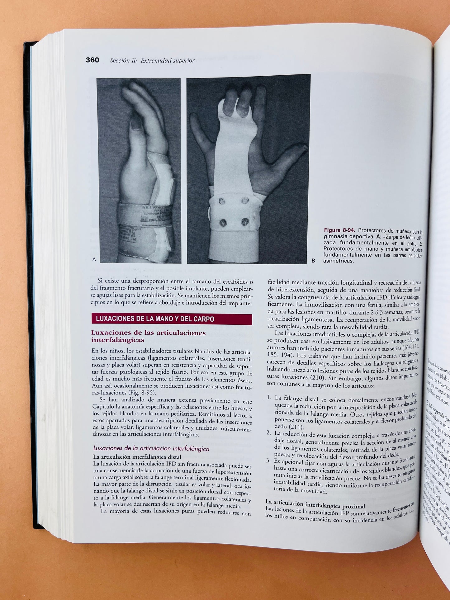 Rockwood & Wilkins Fracturas en el niño quinta edición