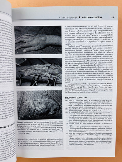 Greens Cirugía de la mano 2 volumenes