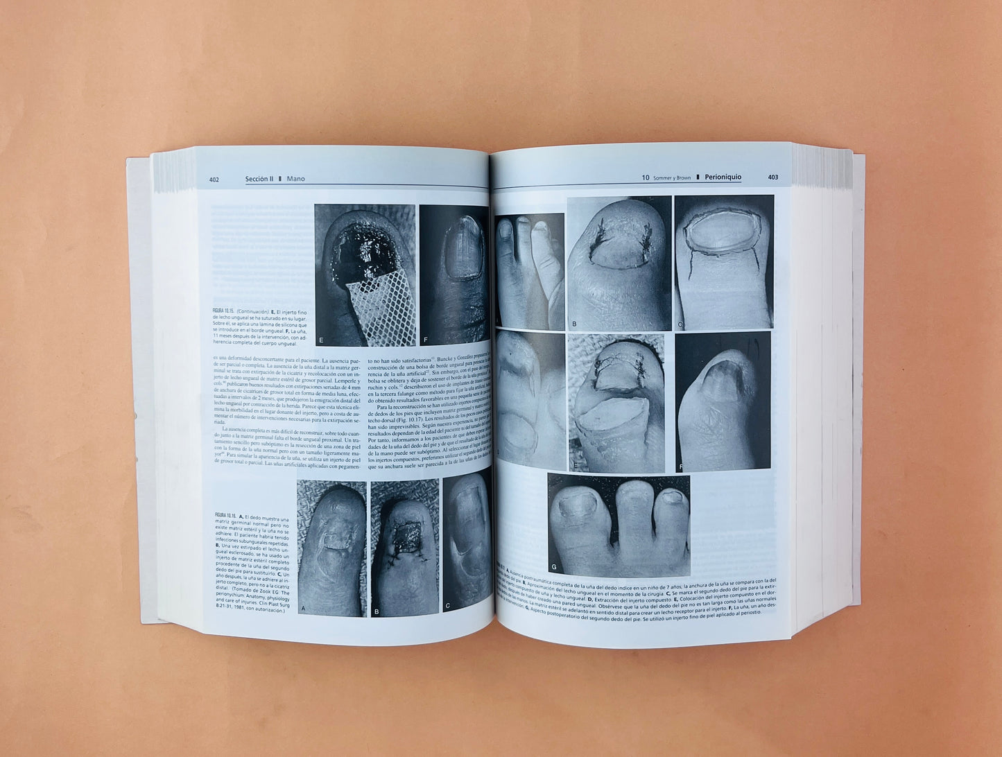 Greens Cirugía de la mano 2 volumenes