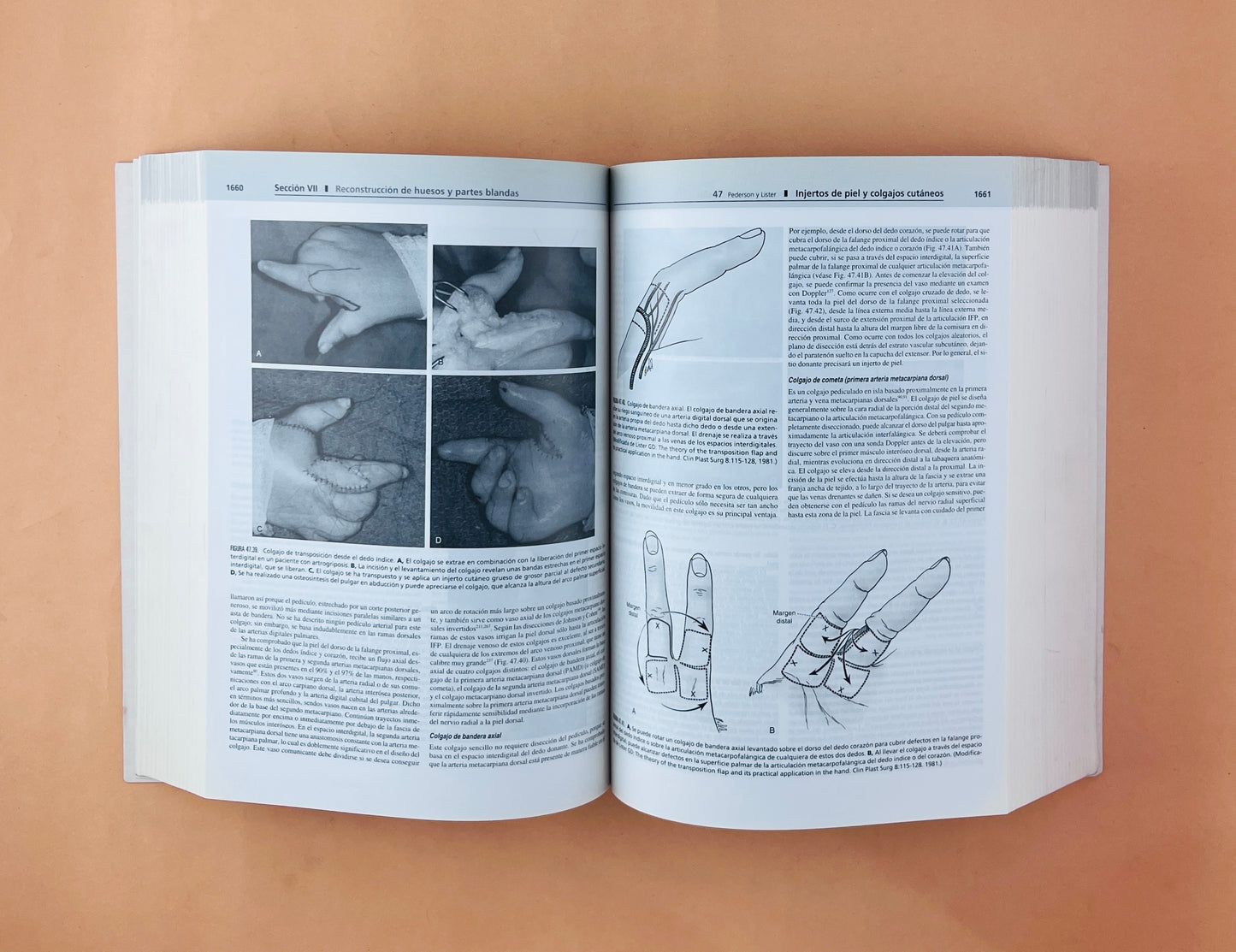 Greens Cirugía de la mano 2 volumenes