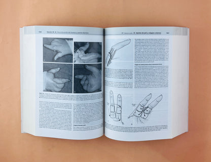 Greens Cirugía de la mano 2 volumenes