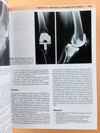 Rodilla 2 volúmenes