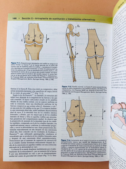 Rodilla 2 volúmenes