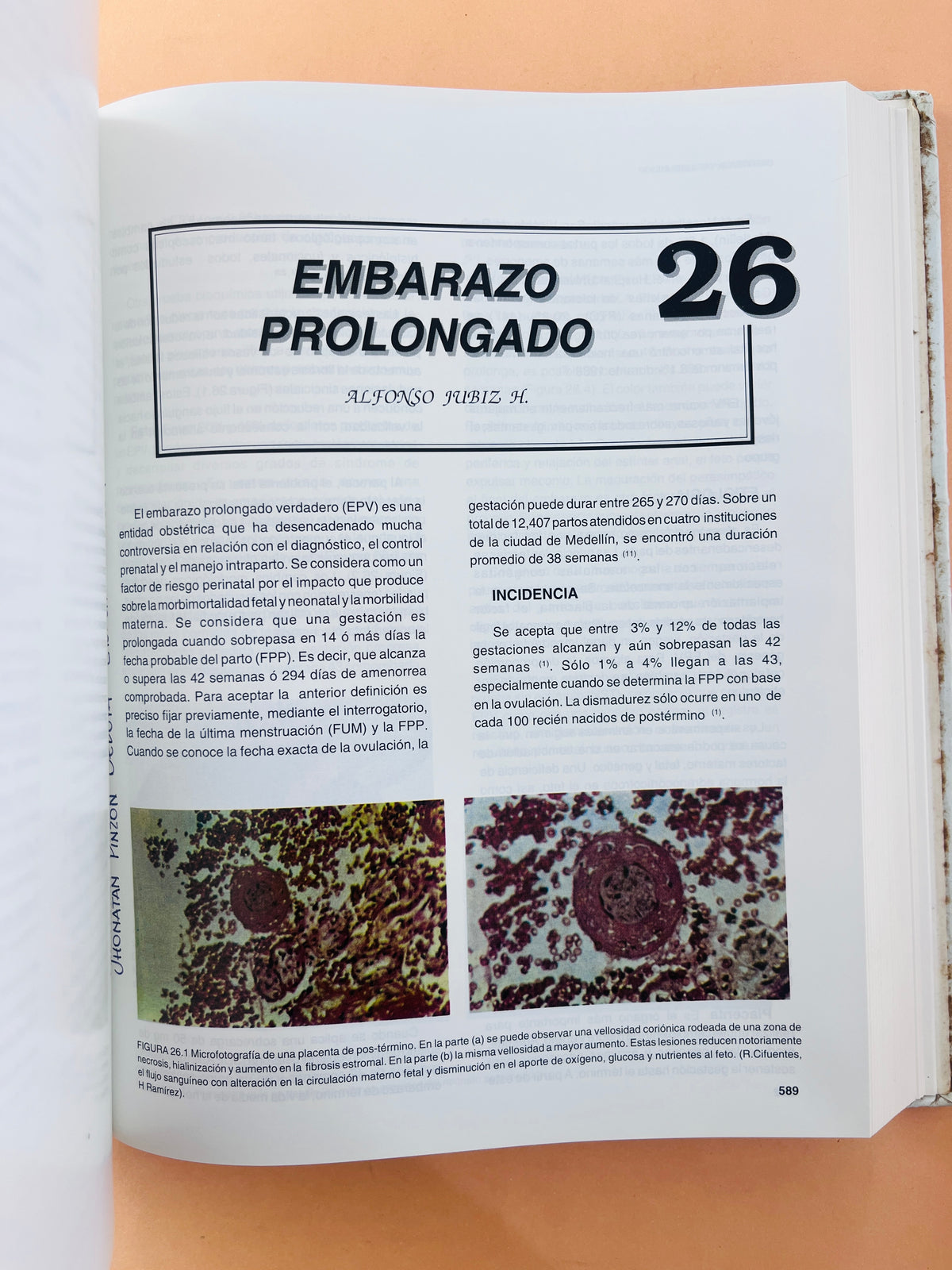 Obstetricia de alto riesgo cuarta edición by R. Cifuentes B.