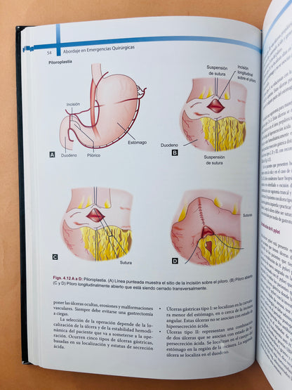 Abordaje en Emergencias Quirúrgicas