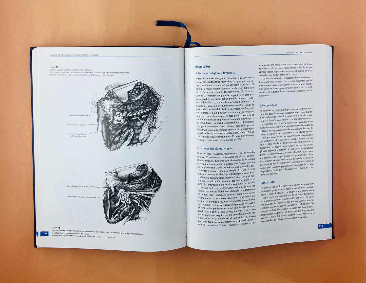 Manual de otorrinolaringología,cabeza y cuello