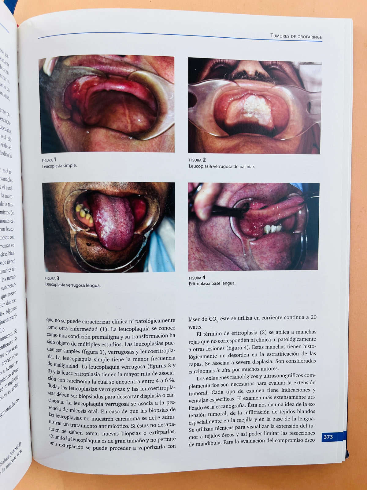 Manual de otorrinolaringología,cabeza y cuello by Augusto Peñaranda Sanjuan Juan Manuel García Gómez Martín Pinzón Navarro