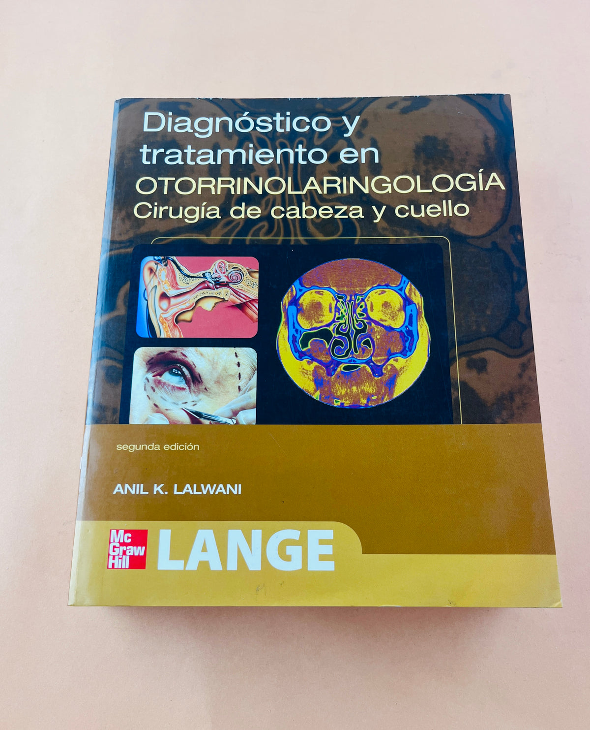 Diagnóstico y tratamiento en Otorrinolaringología cirugía de cabeza y cuello segunda edición by Anil K Lalwani