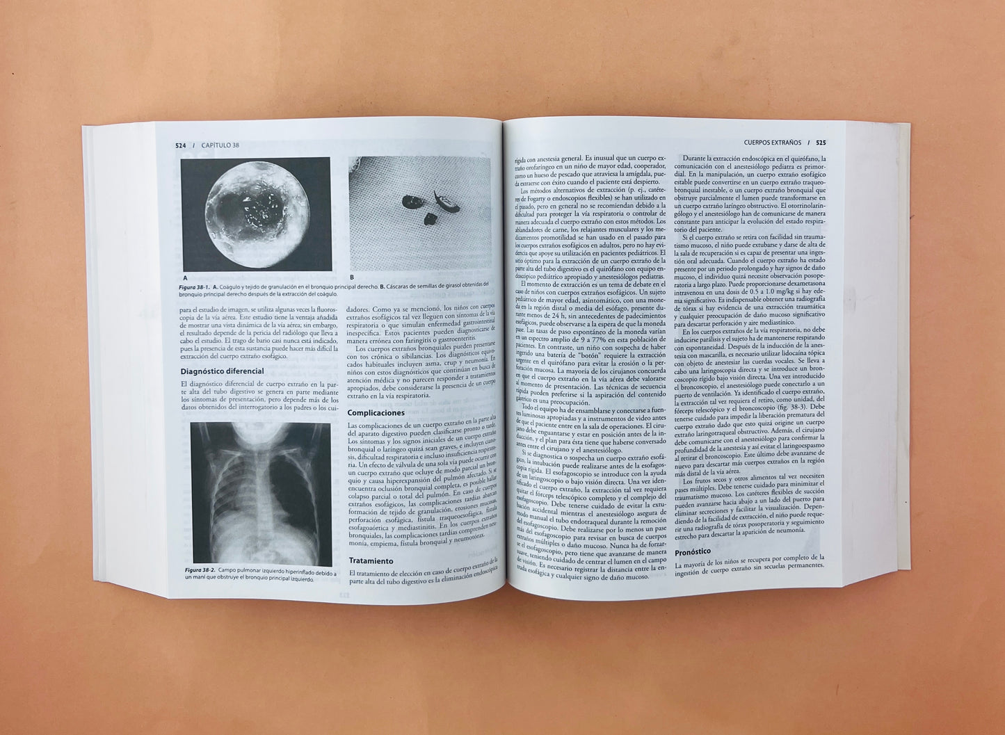 Diagnóstico y tratamiento en Otorrinolaringología cirugía de cabeza y cuello segunda edición