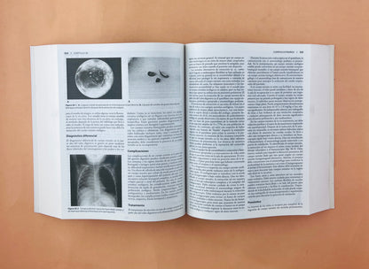 Diagnóstico y tratamiento en Otorrinolaringología cirugía de cabeza y cuello segunda edición