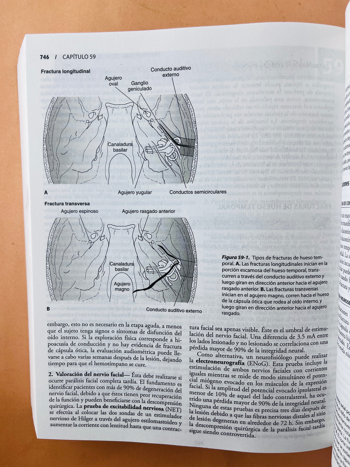 Diagnóstico y tratamiento en Otorrinolaringología cirugía de cabeza y cuello segunda edición by Anil K Lalwani