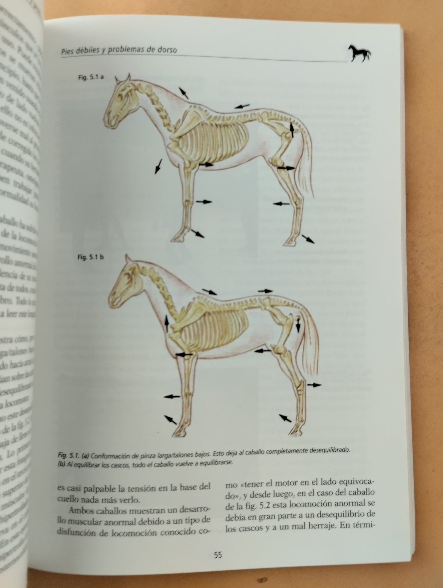 Sin pie no hay caballo