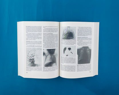 Fundamentos de Pediatria Infectología y Neumología tomo II segunda edición