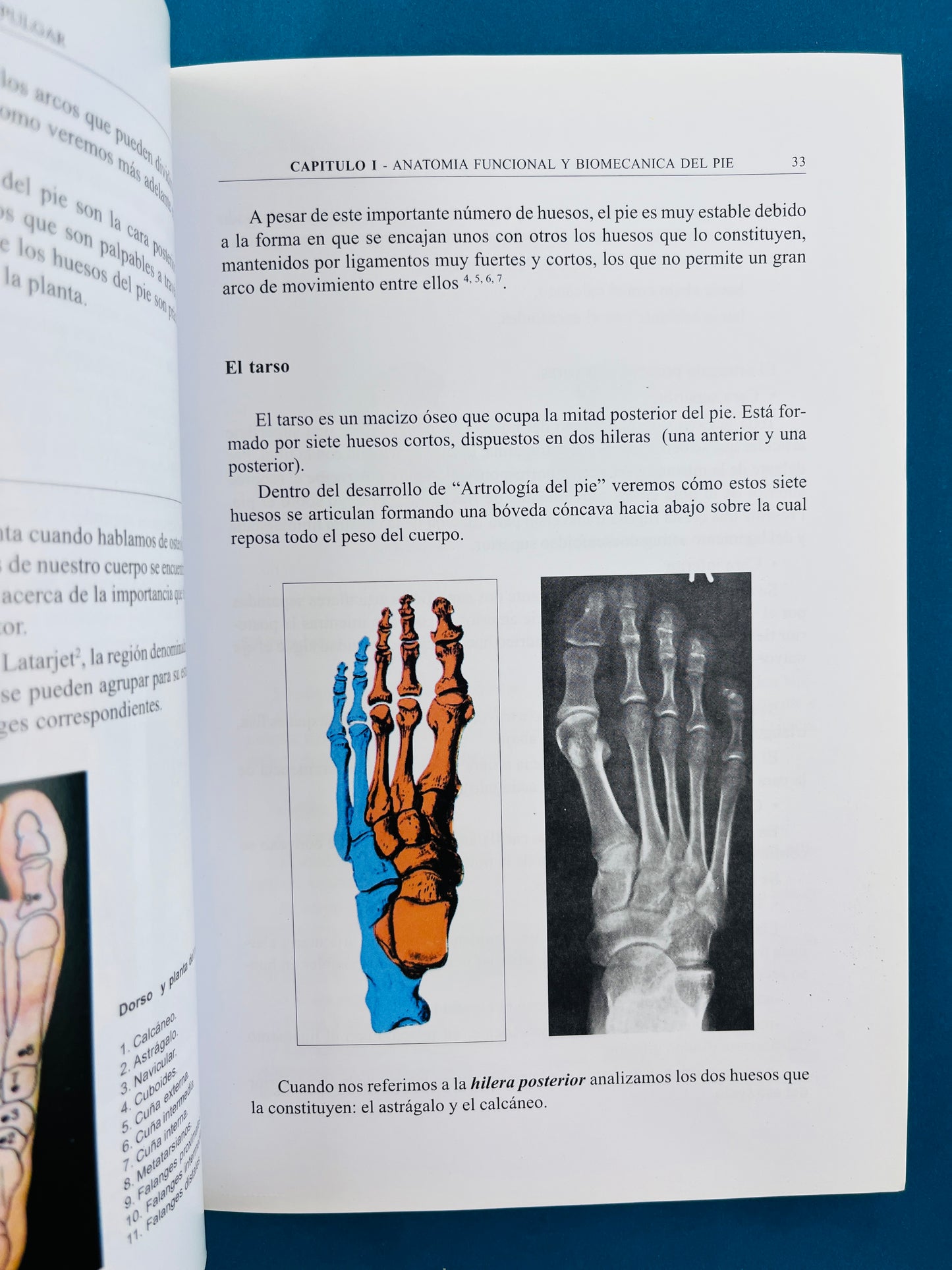 El tratamiento percutáneo del Hallux Valgus con la técnica de Reverdin Isham
